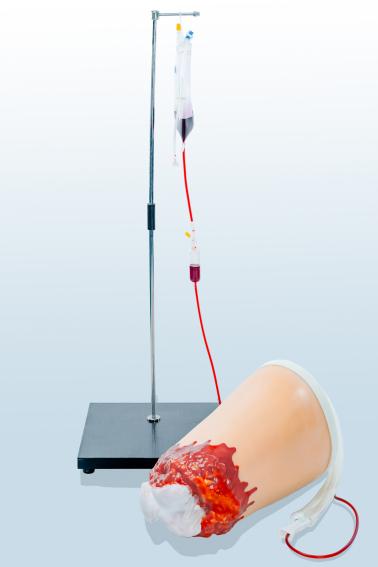  下肢外傷斷肢止血模型